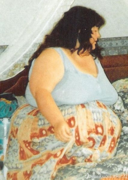 Moteris numetė 140 kilogramų