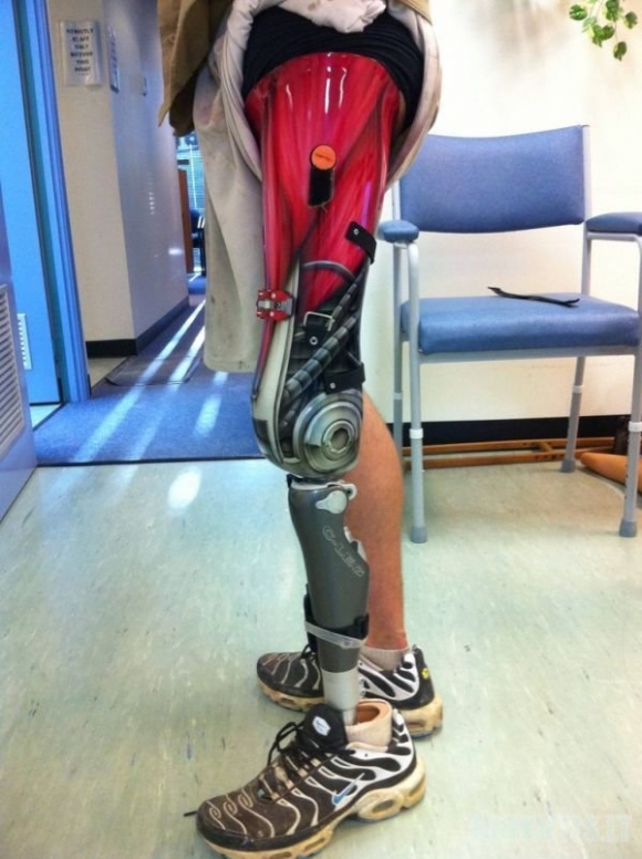 Terminatoriaus protezas