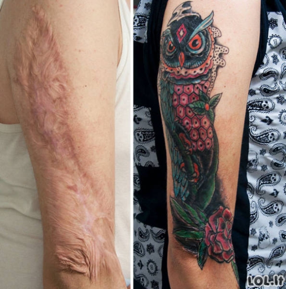 Kaip bjaurius randus pataisyti tatuiruotėmis
