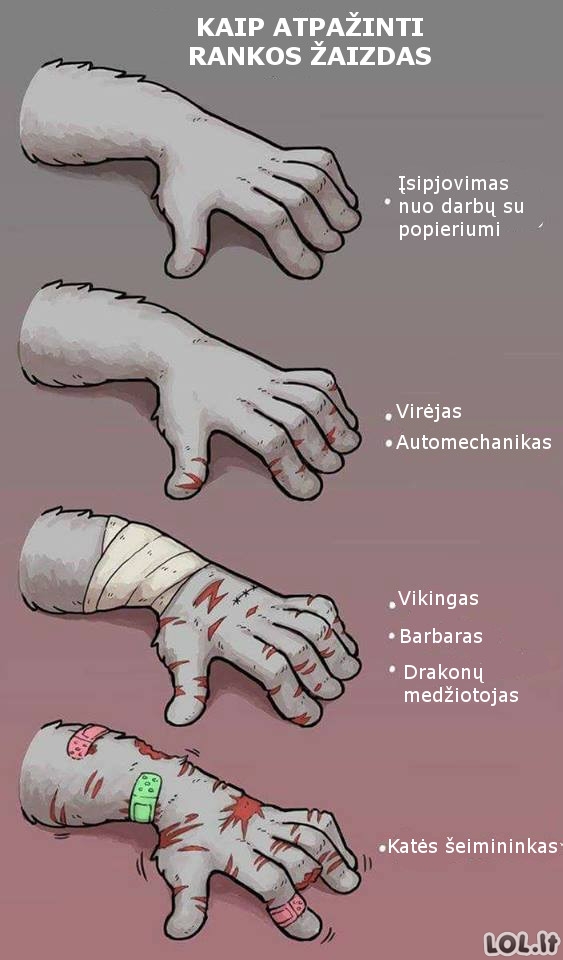 Ką apie jus pasako rankų žaizdos