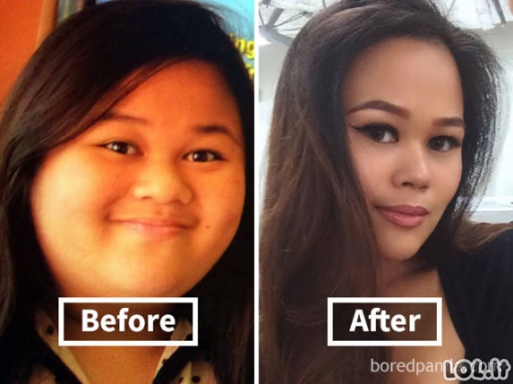 Kaip numesti kilogramai pakeitė žmonių veidus