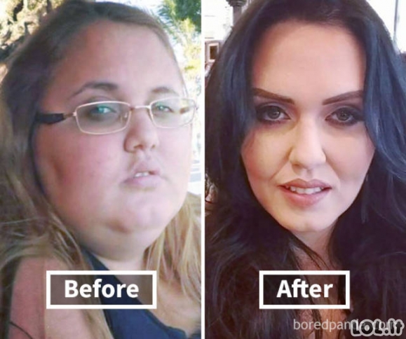 Kaip numesti kilogramai pakeitė žmonių veidus
