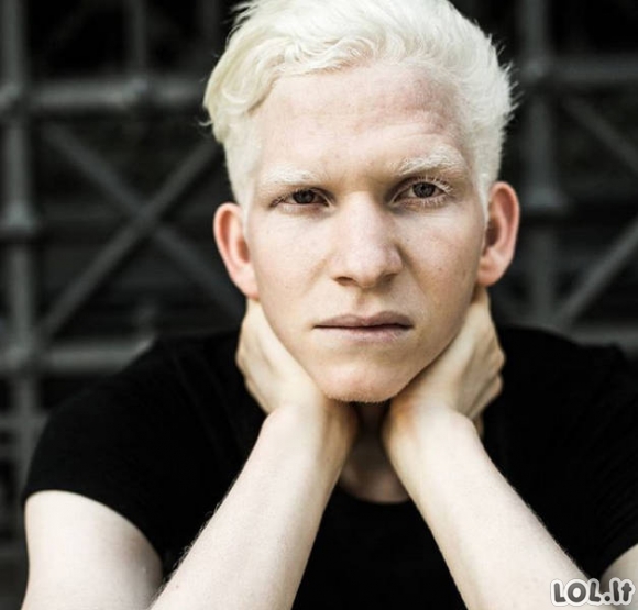 Kaip atrodo įvairių rasių albinosai