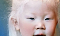 Kaip atrodo įvairių rasių albinosai