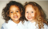 Dvynukės, prieš daugiau, nei 20 metų gimė su skirtinga odos spalva. Pažiūrėkite, kaip jos atrodo dabar