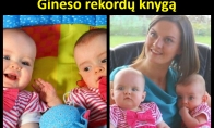 Dvynės atėjo į pasaulį 87 dienų skirtumu ir pateko į Gineso rekordų knygą