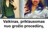 Vaikinas, priklausomas nuo grožio procedūrų, kuris prikausto dėmesį: kaip jis atrodė anksčiau?