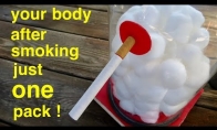 Kaip rūkymas kenkia plaučiams